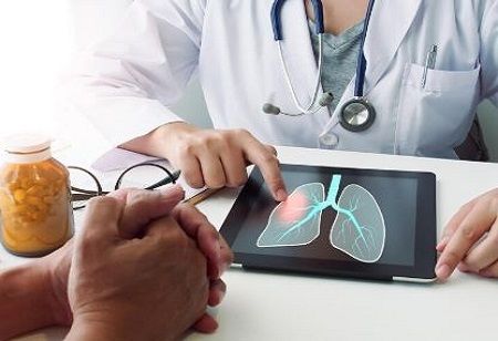 lung cancer care, AstraZeneca,Revna Biosciences